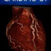 The Complete Guide to Cardiac CT (PDF)