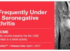 2017 Imaging of Frequently Under Recognized Seronegative Spondyloarthritis (CME VIDEOS)