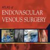 Atlas of Endovascular Venous Surgery, 2nd Edition (Videos, Organized)