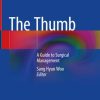 The Thumb: A Guide to Surgical Management
