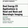 Dual Energy CT: Applications in Head and Neck and Neurologic Imaging, An Issue of Neuroimaging Clinics of North America, E-Book (The Clinics: Radiology 27) 1st Edition