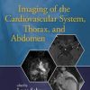Magnetic Resonance Imaging Handbook: Imaging of the Cardiovascular System, Thorax, and Abdomen (Volume 2) 1st Edition