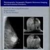 Radiology: Diagnostic Breast Imaging 0th Edition