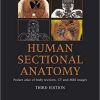 Human Sectional Anatomy: Atlas of Body Sections, CT and MRI Images 3rd Edition