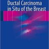 Ductal Carcinoma in Situ of the Breast 1st ed. 2018 Edition