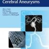 Flow Diversion of Cerebral Aneurysms 1st Edition