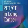 PET/CT in Lung Cancer (Clinicians’ Guides to Radionuclide Hybrid Imaging) 1st ed. 2018 Edition