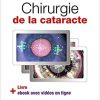 Chirurgie De La Cataracte: 60 Videos Sequencees (French Edition) (French)