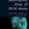Radiological Atlas of Child Abuse: A Complete Resource for MCQs, v. 1 1st Edition