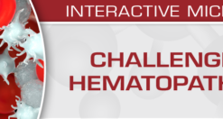 USCAP Challenges in Hematopathology 2019 (CME VIDEOS)