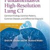 Fundamentals of High-Resolution Lung CT: Common Findings, Common Patterns, Common Diseases and Differential Diagnosis (Pocket Notebook) Second Edition