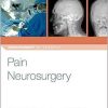 Pain Neurosurgery (Neurosurgery by Example) 1st