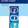Diagnostic Imaging of the Chest 1st Edición