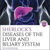Sherlock’s Diseases of the Liver and Biliary System 13th Edition