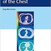 Diagnostic Imaging of the Chest 1st Edition