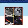 Ultrasound Q&A Review for the Boards 1st Edition