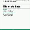 MRI of the Knee, An Issue of Magnetic Resonance Imaging Clinics of North America (The Clinics: Radiology) 1st Edition