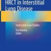 HRCT in Interstitial Lung Disease: Instructive Case Studies 1st ed. 2019 Edition