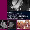 Cardiac MRI in Diagnosis, Clinical Management, and Prognosis of Arrhythmogenic Right Ventricular Cardiomyopathy/Dysplasia 1st Edition