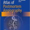 Atlas of Postmortem Angiography 1st ed. 2016 Edition