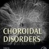 Choroidal Disorders 1st Edition