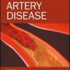 Peripheral Artery Disease 2nd Edition