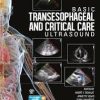 Basic Transesophageal and Critical Care Ultrasound 1st Edition