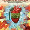 Cardiovascular Thrombus: From Pathology and Clinical Presentations to Imaging, Pharmacotherapy and Interventions 1st Edition