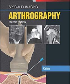 Specialty Imaging: Arthrography (Inglés) 2nd Edición