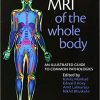 MRI of the Whole Body: An Illustrated Guide for Common Pathologies 1/E Edition