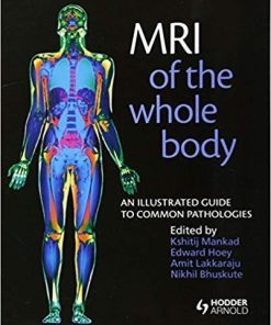 MRI of the Whole Body: An Illustrated Guide for Common Pathologies 1/E Edition