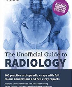 The Unofficial Guide to Radiology: 100 Practice Orthopaedic X-Rays with Full Colour Annotations and Full X-Ray Reports (Unofficial Guides to Medicine)