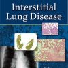Interstitial Lung Disease 5th