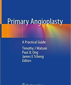 Primary Angioplasty: A Practical Guide