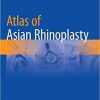 Atlas of Asian Rhinoplasty Softcover reprint of the original 1st ed. 2018 Edition