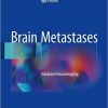 Brain Metastases: Advanced Neuroimaging 1st ed. 2018 Edition