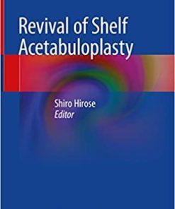 Revival of Shelf Acetabuloplasty 1st ed. 2018 Edition