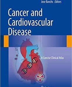 Cancer and Cardiovascular Disease: A Concise Clinical Atlas 1st ed. 2018 Edition