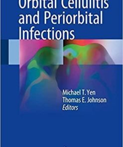 Orbital Cellulitis and Periorbital Infections 1st ed. 2018 Edition