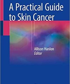 A Practical Guide to Skin Cancer 1st ed. 2018 Edition