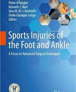 Sports Injuries of the Foot and Ankle: A Focus on Advanced Surgical Techniques 1st ed. 2019 Edition