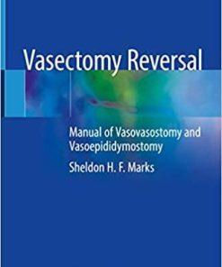 Vasectomy Reversal: Manual of Vasovasostomy and Vasoepididymostomy 1st ed. 2019 Edition