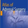 Atlas of Adrenal Surgery 1st ed. 2019 Edition