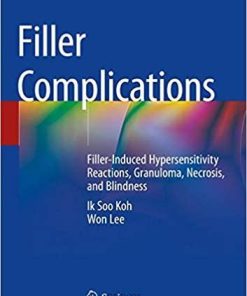 Filler Complications: Filler-Induced Hypersensitivity Reactions, Granuloma, Necrosis, and Blindness 1st ed. 2019 Edition