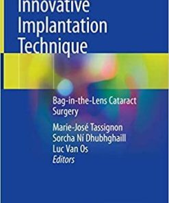 Innovative Implantation Technique: Bag-in-the-Lens Cataract Surgery 1st ed. 2019 Edition