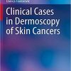 Clinical Cases in Dermoscopy of Skin Cancers (Clinical Cases in Dermatology) 1st ed. 2020 Edition