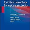 Compression Sutures for Critical Hemorrhage During Cesarean Section: A Guide by CG Animation 1st ed. 2020 Edition