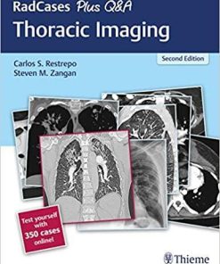 RadCases Plus Q&A Thoracic Imaging 2nd Edition