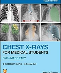 Chest X-Rays for Medical Students: CXRs Made Easy 2nd Edition