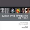 Imaging of the Reproductive Age Female,An Issue of Radiologic Clinics of North America (Volume 58-2) (The Clinics: Radiology (Volume 58-2))